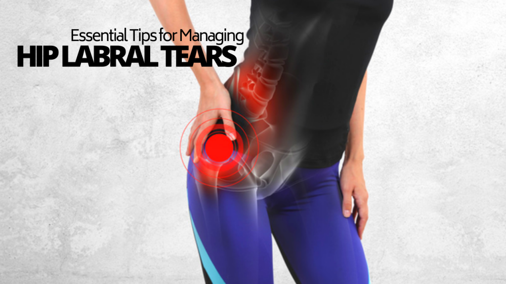 Hip Labral Tears Types